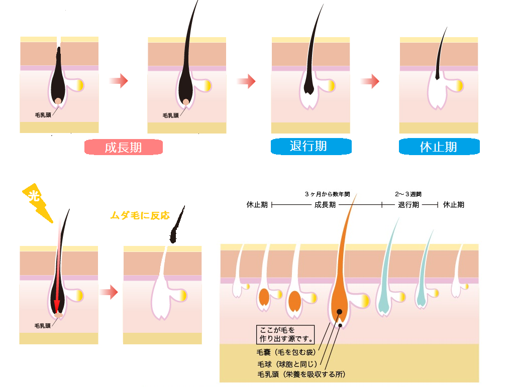 　当店ではフラッシュ脱毛を導入しています。光は黒いものに反応します。成長期の毛が光に反応して抜けていき、２カ月くらい経つと、眠っていた毛が成長期になり、そこにまた、光を当てていきます。この施術を繰り返し、完了へと向かっていきます！！